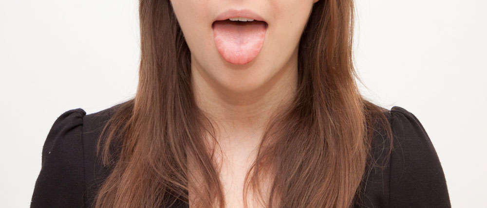 乾燥肌　舌　健康状態