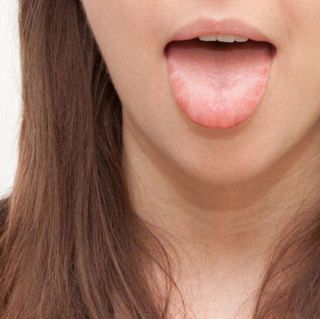 乾燥肌 舌　健康状態